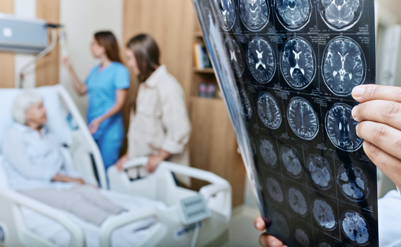 MRI of head of elderly woman in hands of doctor standing in medical ward near senior patient