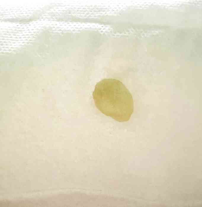 mucus