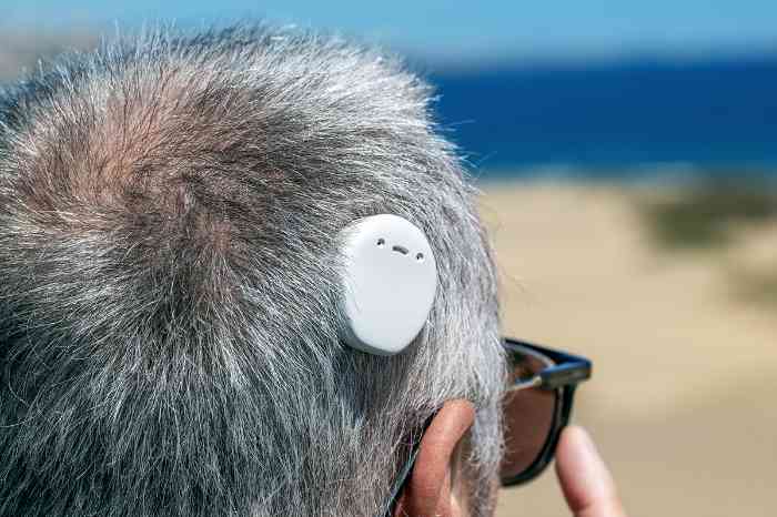 A man with bone conduction ha