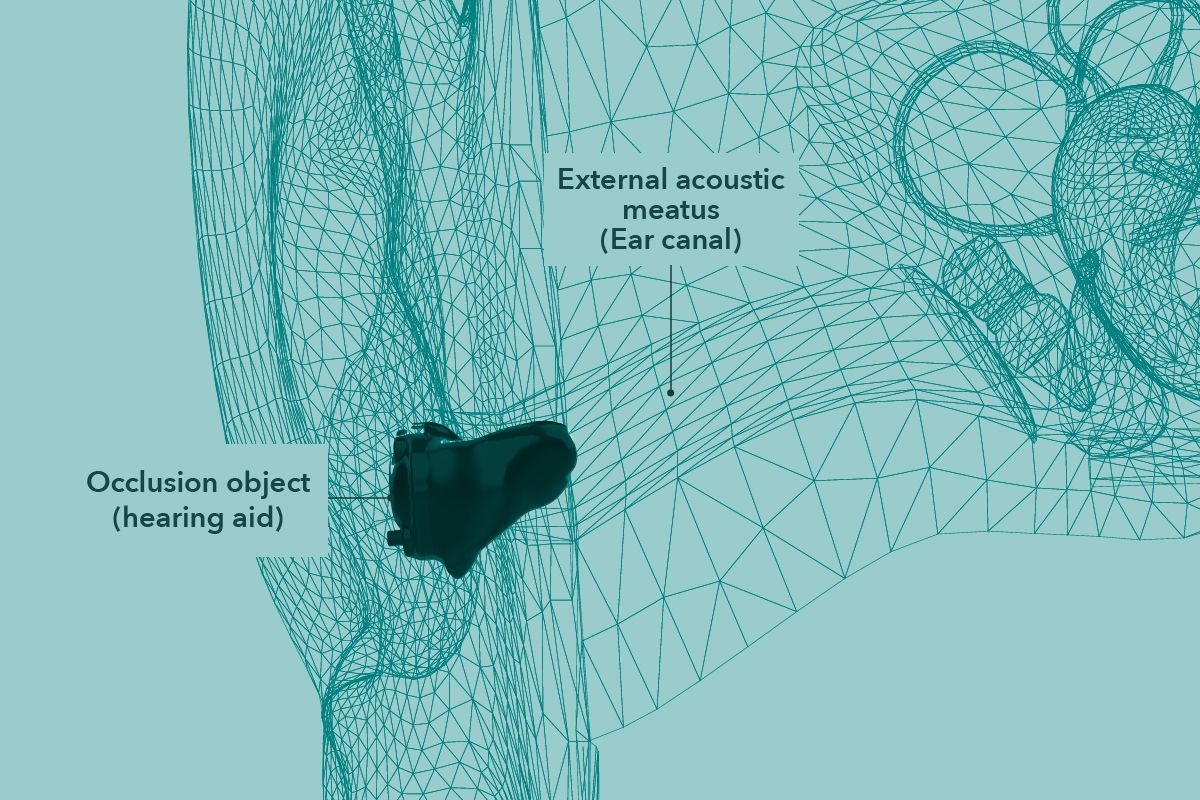 The occlusion effect Causes & solutions MiracleEar