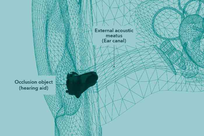 Hearing aid occlusion effect