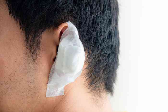 Ear after meatoplasty surgery