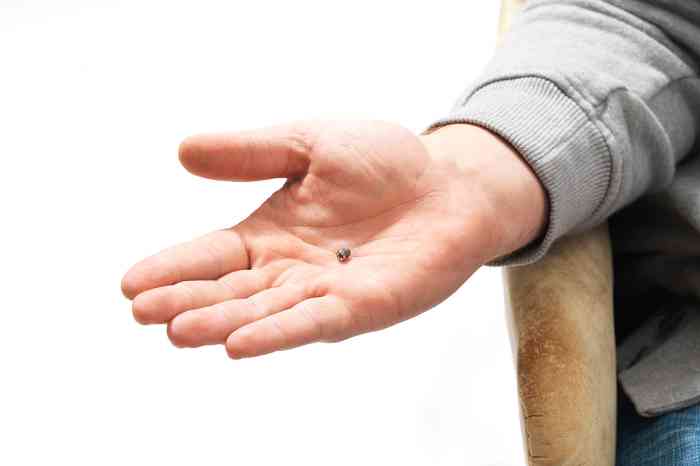 BAHA hearing aid on a hand
