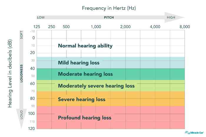 Table of degrees of hearing loss